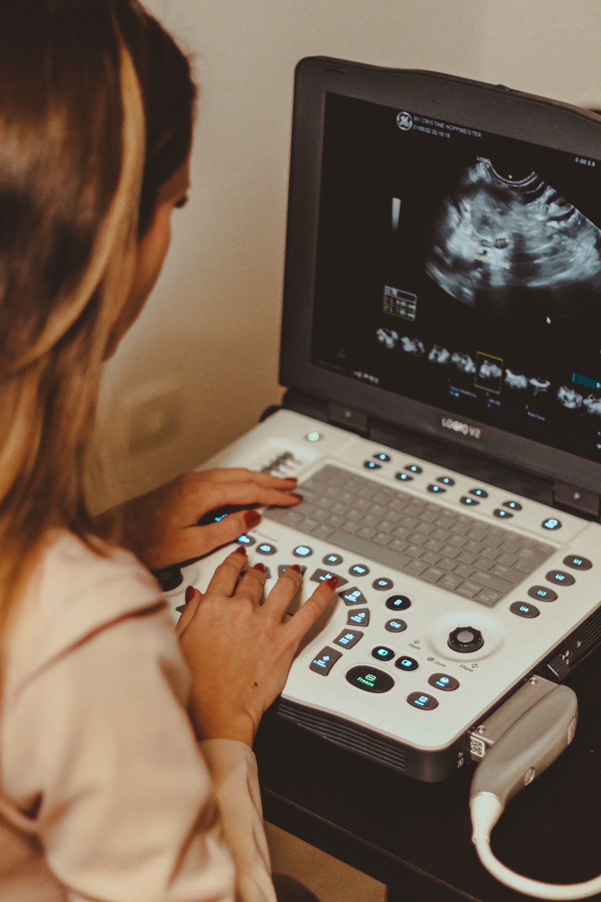 Aparelho de ultrassom veterinário com imagem real de diagnóstico